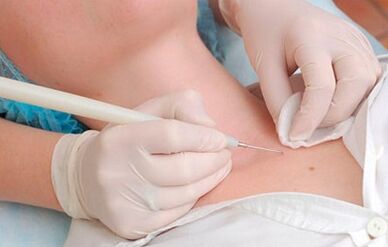 Die Ursachen des menschlichen Papillomavirus