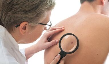 Menschlicher Papillomavirus bei Männern