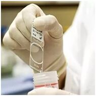 Papillominfektionsdiagnose