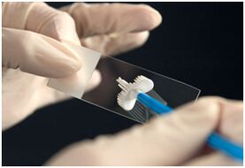 Papst -Test für die Papillomavirus -Infektion