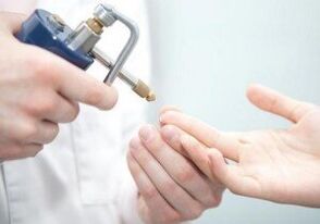 moderne Methoden zur Entfernung von Papillomen.